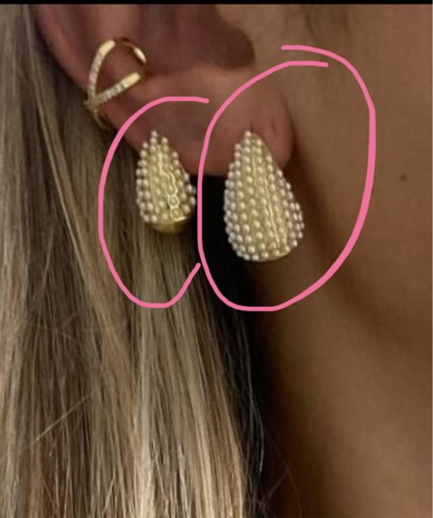 Arete BELY